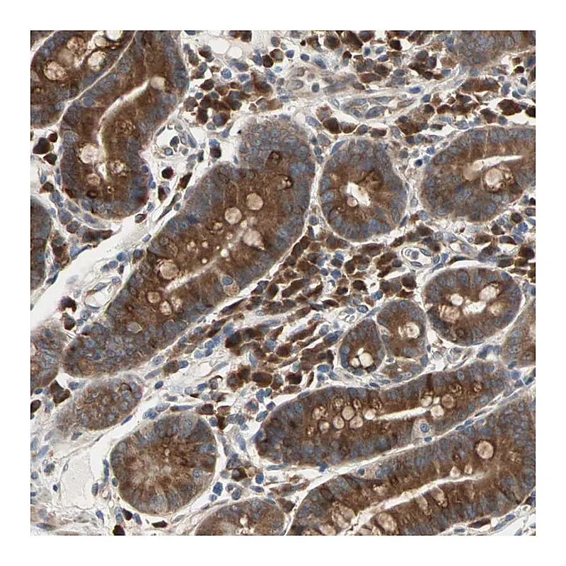 Atlas Antibodies Anti-SAR1A Antibody