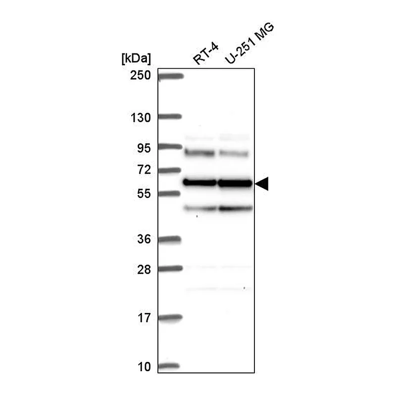 Atlas Antibodies Anti-SARS Antibody