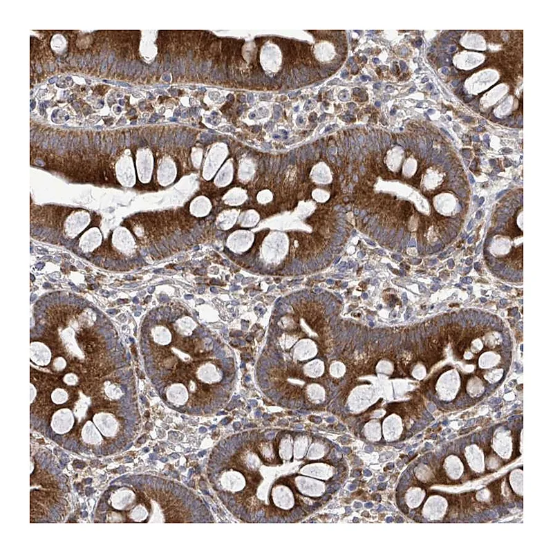 Atlas Antibodies Anti-SAR1B Antibody