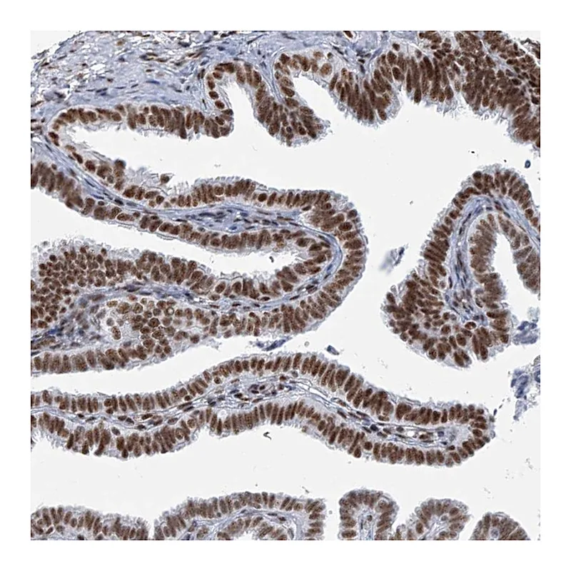 Atlas Antibodies Anti-SARNP Antibody