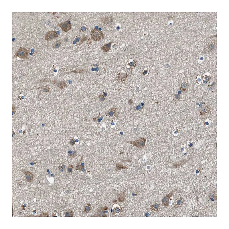 Atlas Antibodies Anti-SARS Antibody