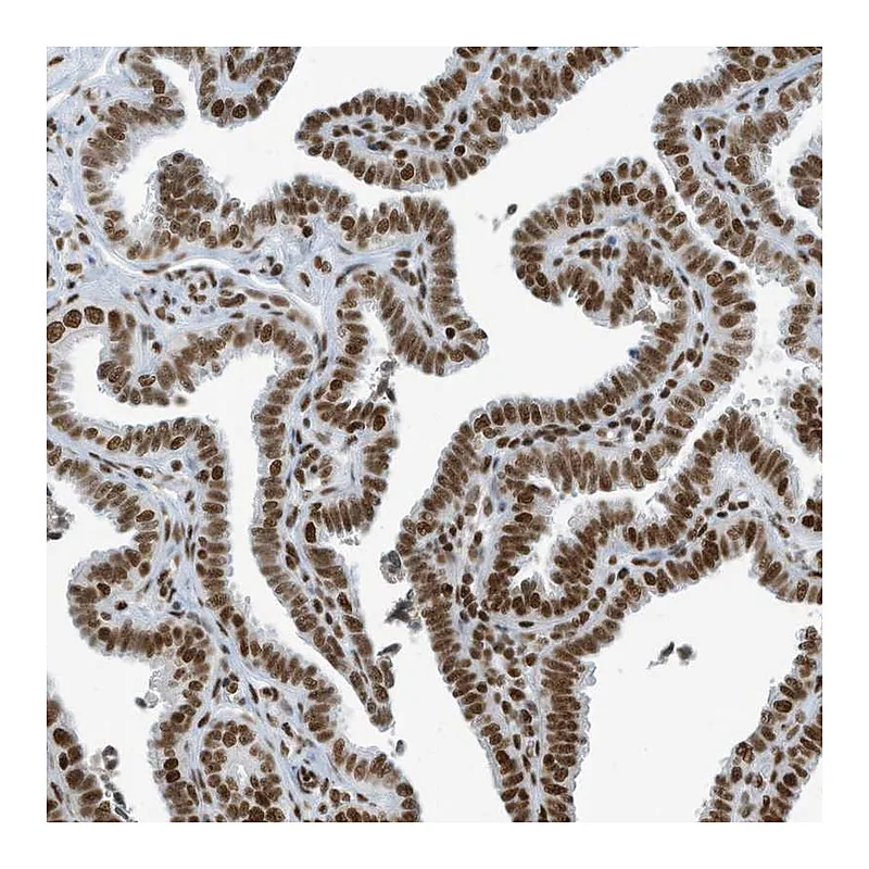 Atlas Antibodies Anti-SARNP Antibody