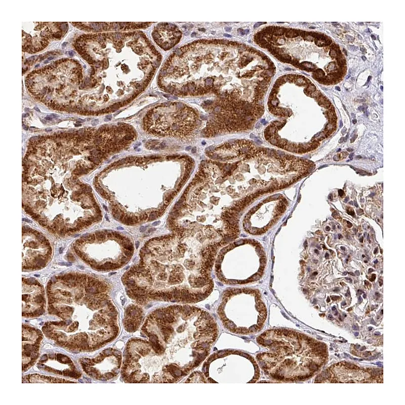 Atlas Antibodies Anti-SARS2 Antibody