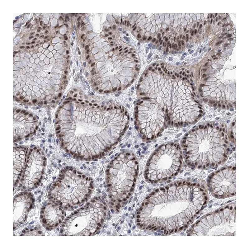Atlas Antibodies Anti-SART1 Antibody