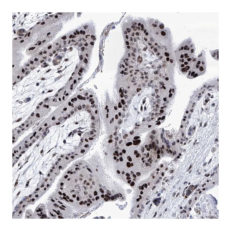 Atlas Antibodies Anti-SART1 Antibody