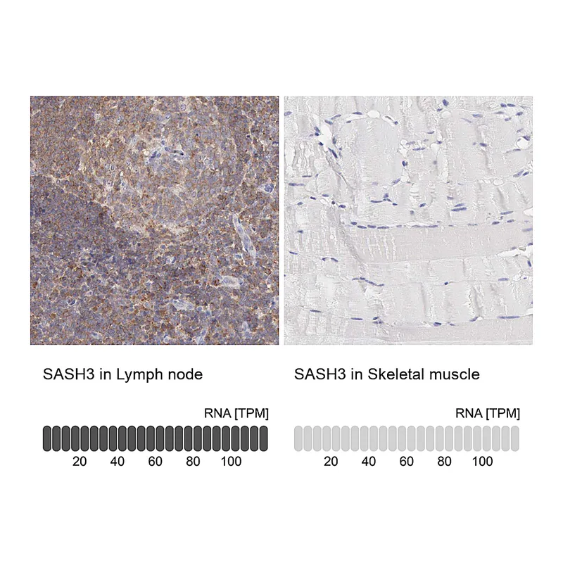 Atlas Antibodies Anti-SASH3 Antibody