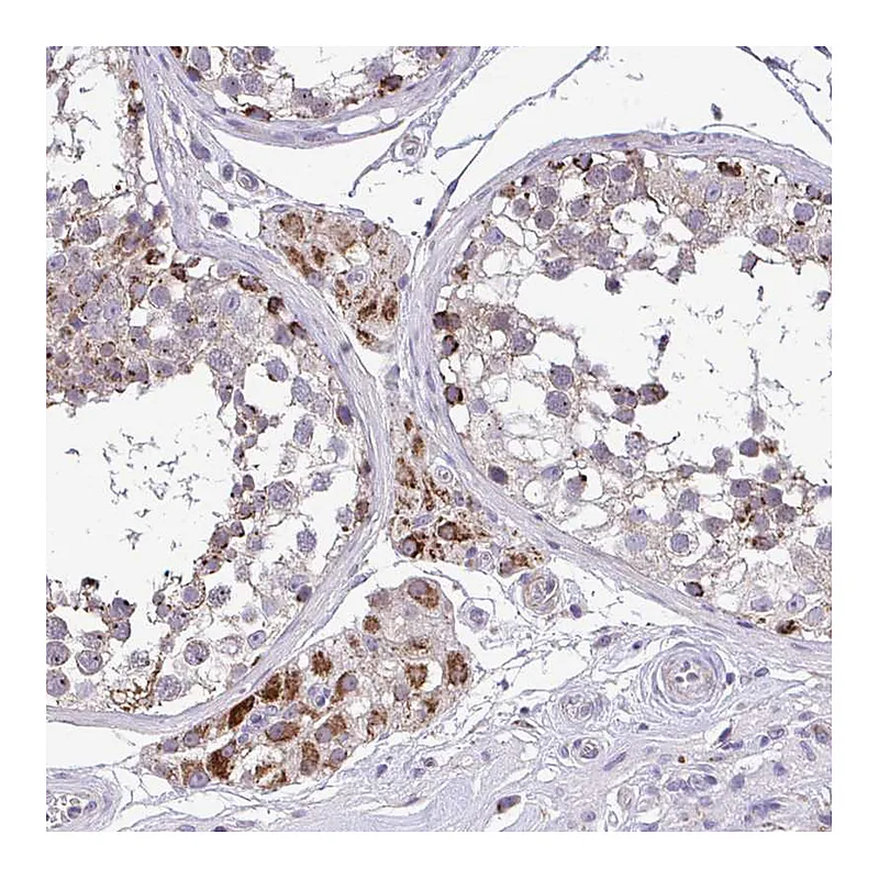 Atlas Antibodies Anti-SARS2 Antibody
