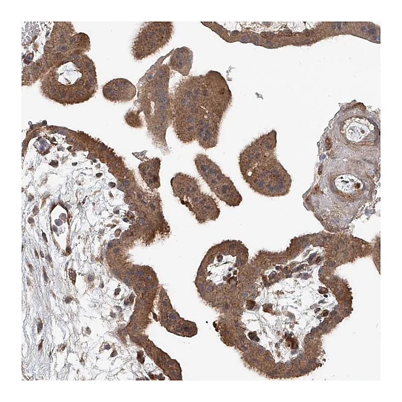 Atlas Antibodies Anti-SASH1 Antibody