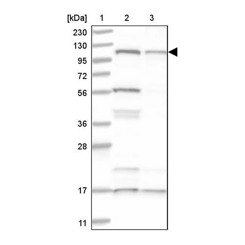 Atlas Antibodies Anti-SART1 Antibody