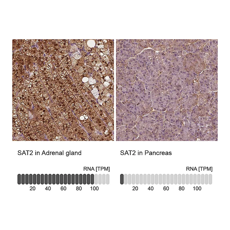 Atlas Antibodies Anti-SAT2 Antibody