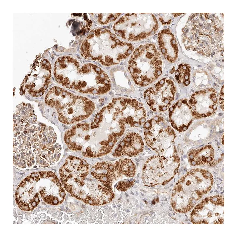 Atlas Antibodies Anti-SASS6 Antibody