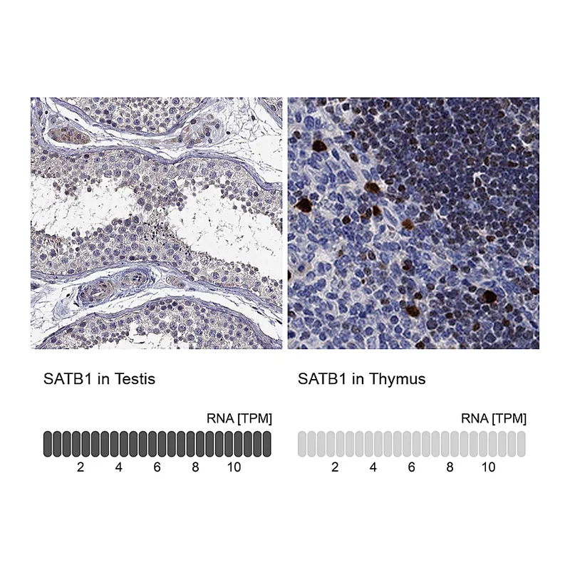 Atlas Antibodies Anti-SATB1 Antibody
