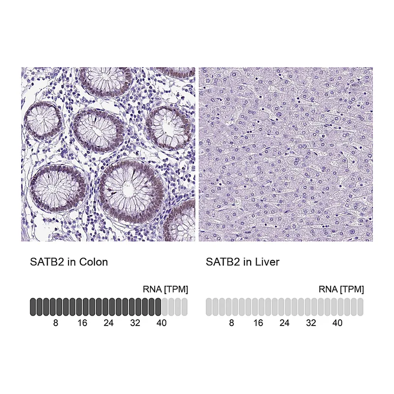 Atlas Antibodies Anti-SATB2 Antibody