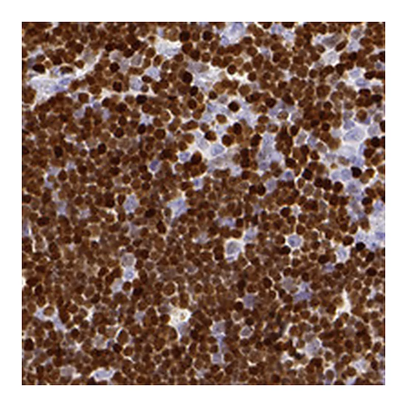 Atlas Antibodies Anti-SATB1 Antibody