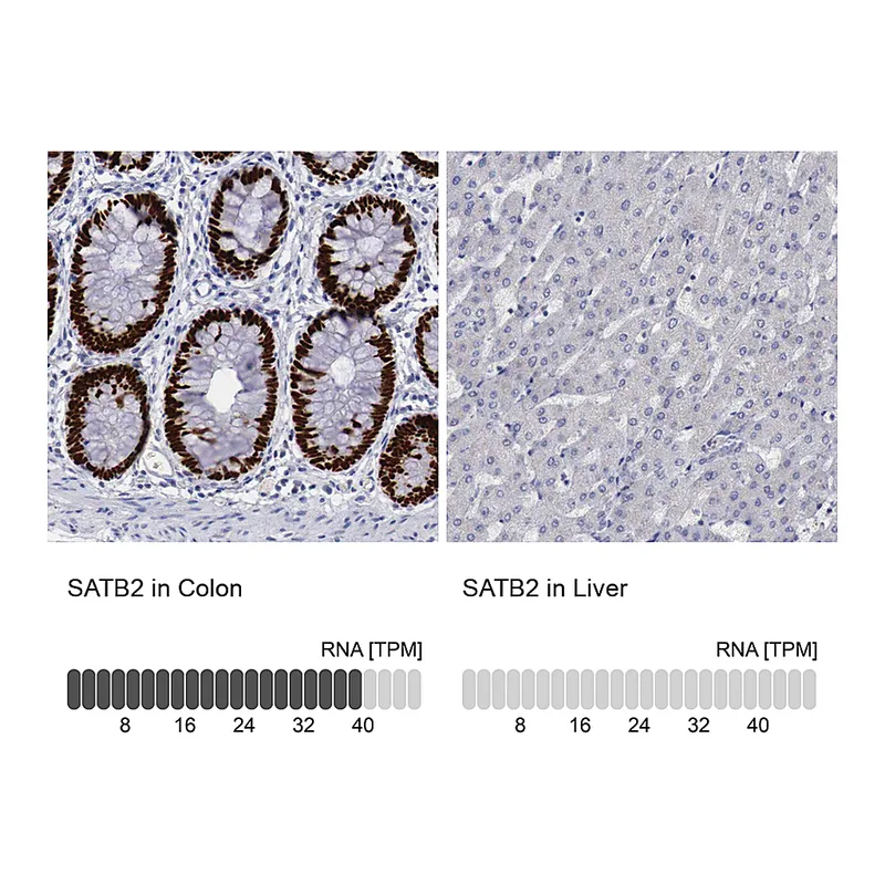 Atlas Antibodies Anti-SATB2 Antibody