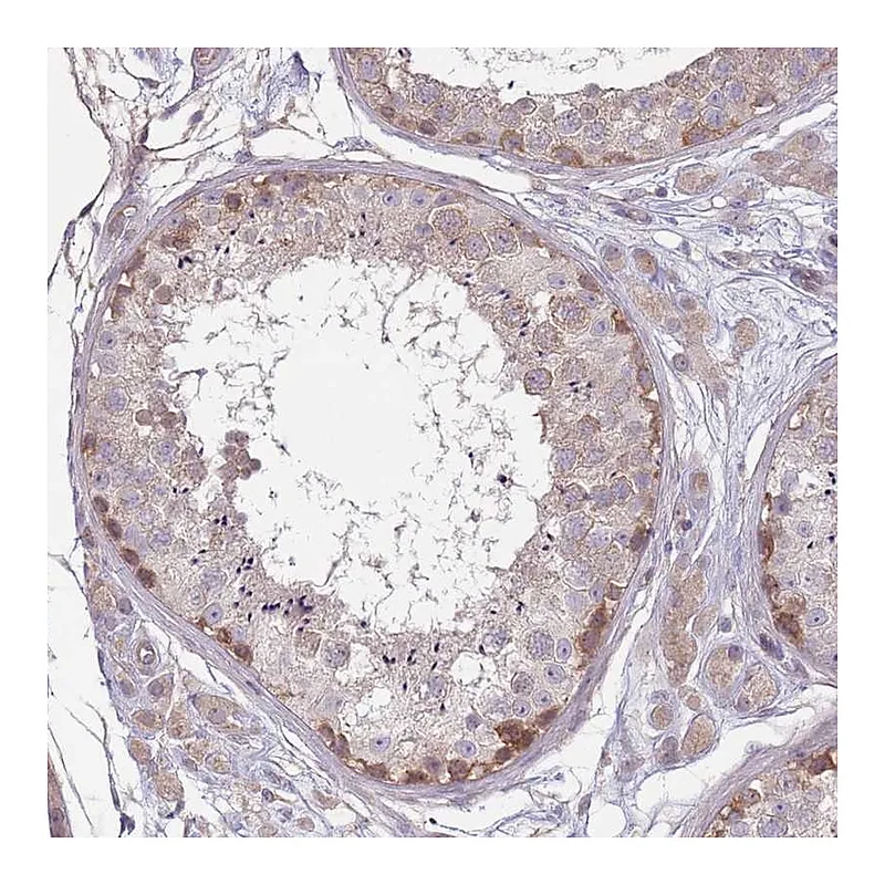 Atlas Antibodies Anti-SAV1 Antibody