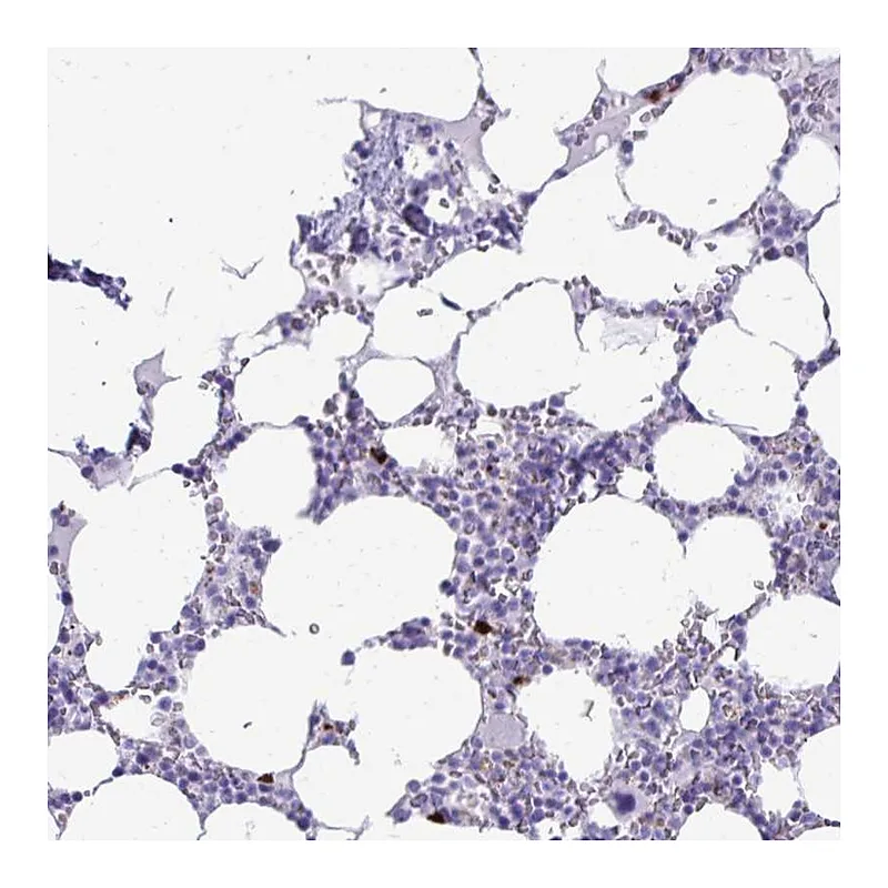 Atlas Antibodies Anti-SATL1 Antibody