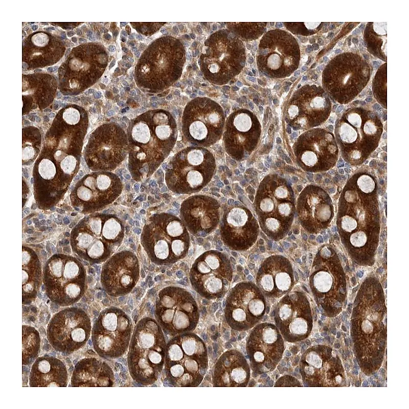 Atlas Antibodies Anti-SBDS Antibody