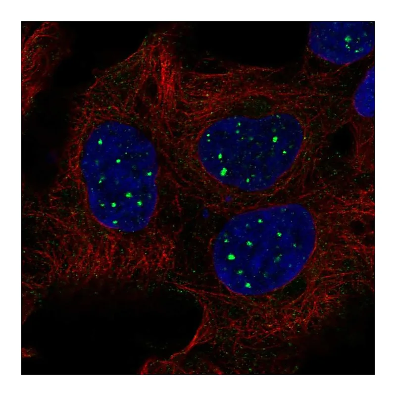 Atlas Antibodies Anti-SBF1 Antibody