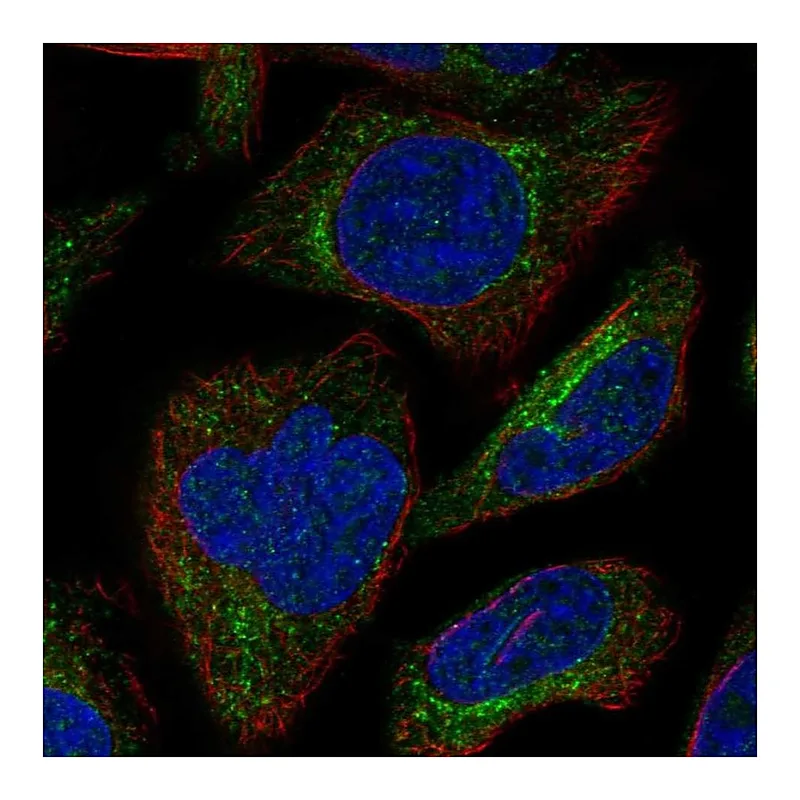 Atlas Antibodies Anti-SBK3 Antibody
