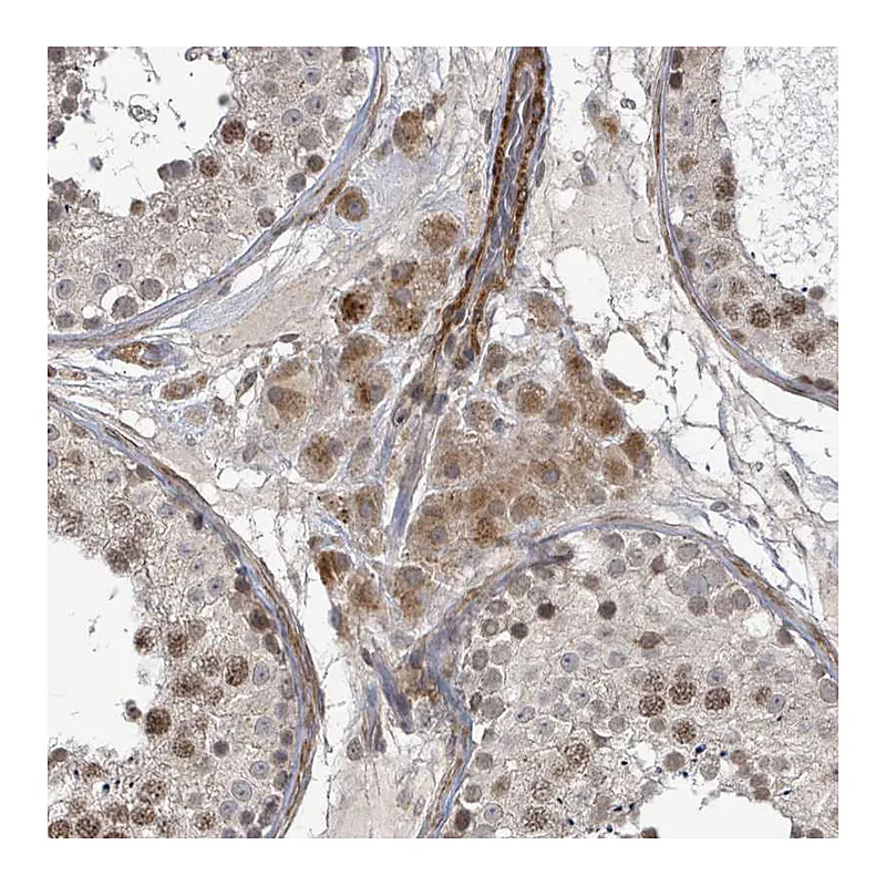 Atlas Antibodies Anti-SBF2 Antibody