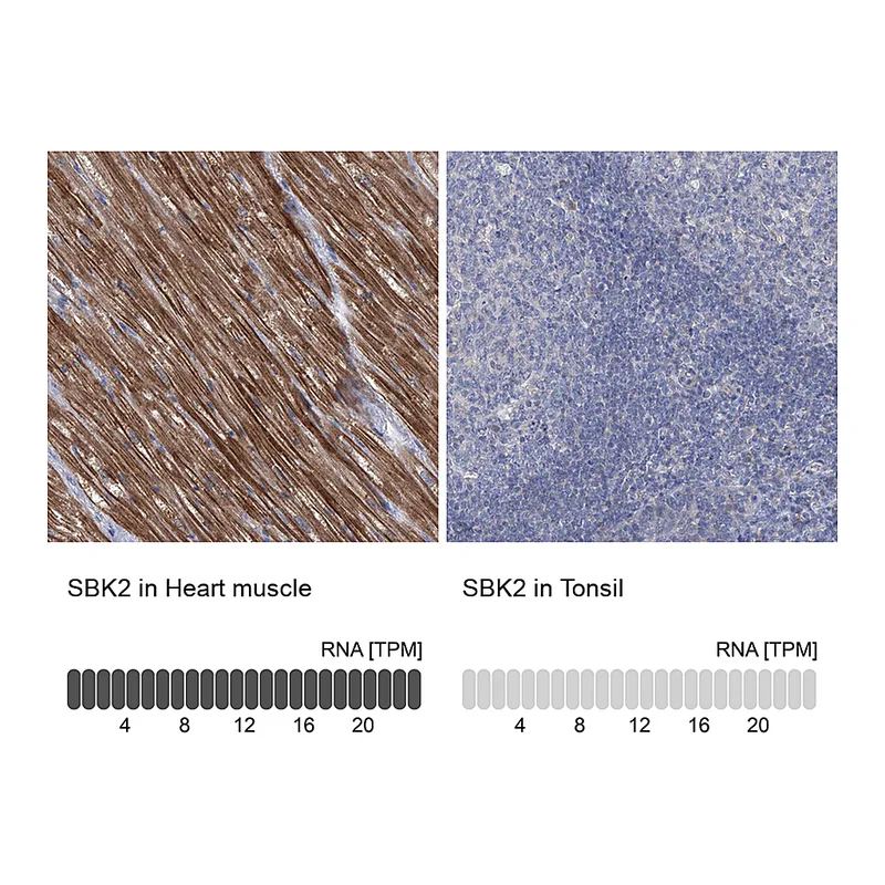 Atlas Antibodies Anti-SBK2 Antibody