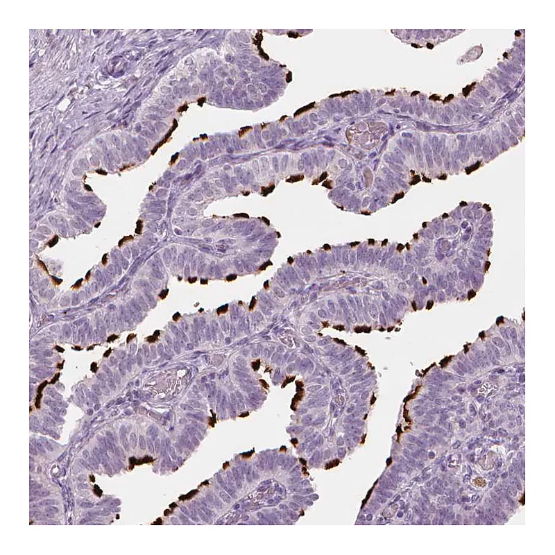 Atlas Antibodies Anti-SAXO2 Antibody