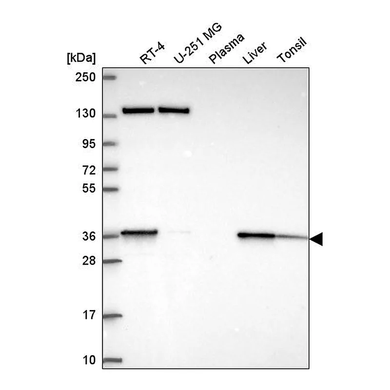 Atlas Antibodies Anti-SC5D Antibody