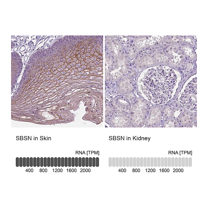 Atlas Antibodies Anti-SBSN Antibody