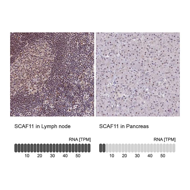 Atlas Antibodies Anti-SCAF11 Antibody