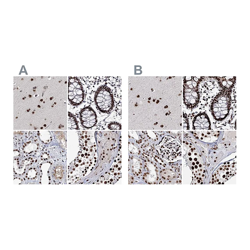 Atlas Antibodies Anti-SCAF8 Antibody