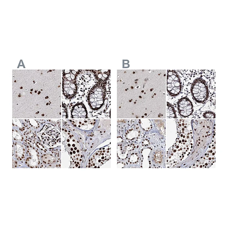 Atlas Antibodies Anti-SCAF8 Antibody