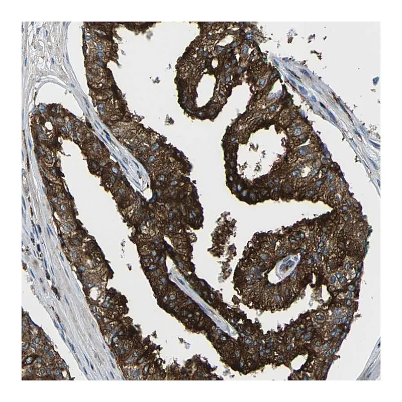 Atlas Antibodies Anti-SCAMP2 Antibody