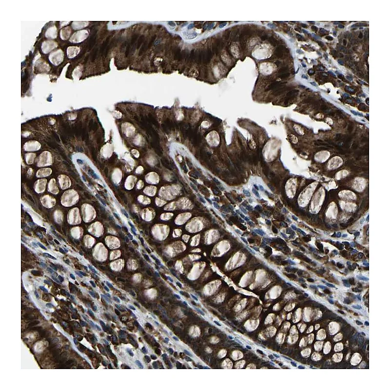 Atlas Antibodies Anti-SCAMP2 Antibody
