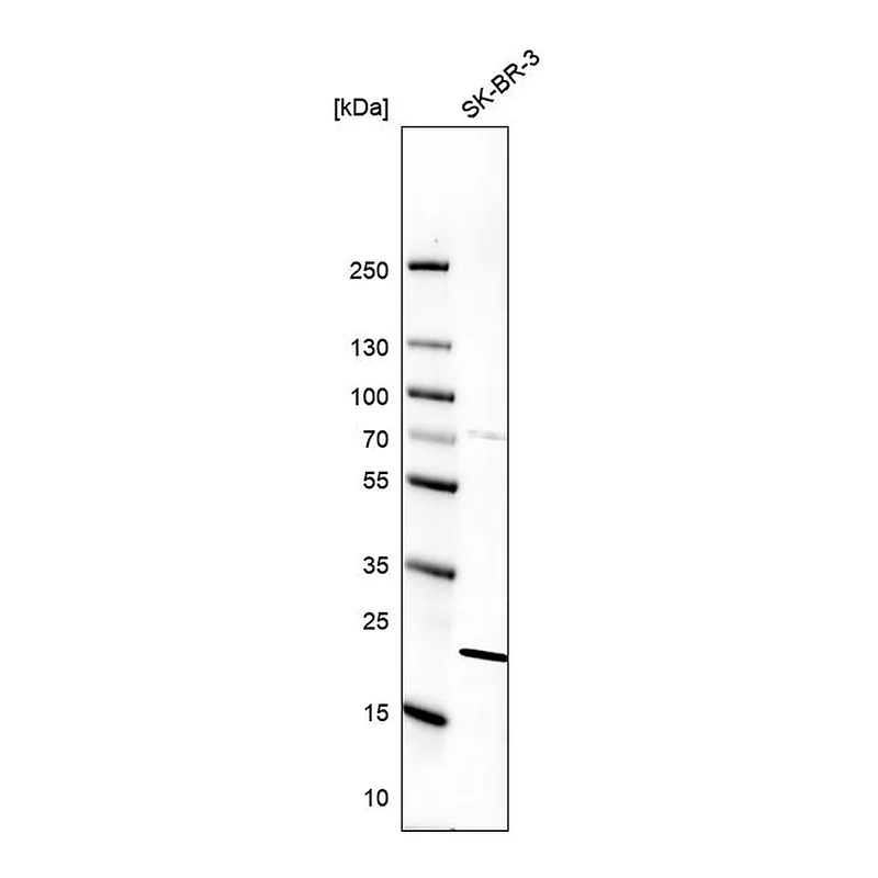 Atlas Antibodies Anti-SCAND1 Antibody