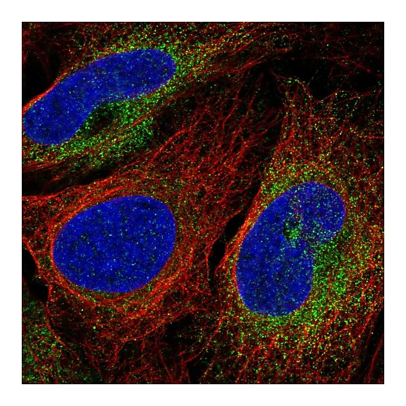Atlas Antibodies Anti-SCARA3 Antibody