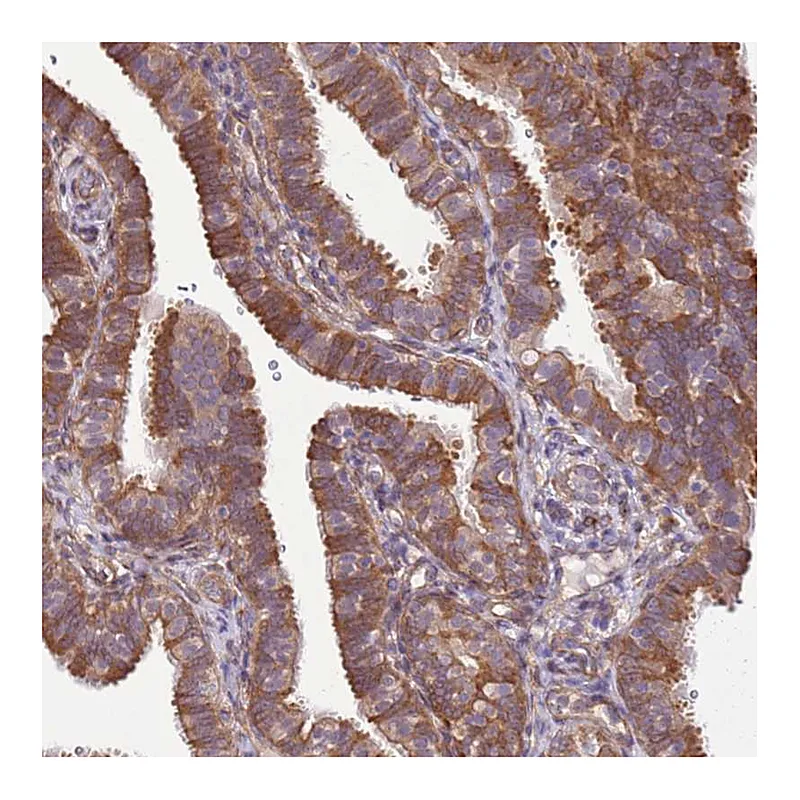 Atlas Antibodies Anti-SCARA3 Antibody