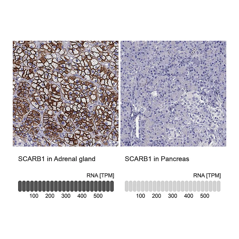 Atlas Antibodies Anti-SCARB1 Antibody