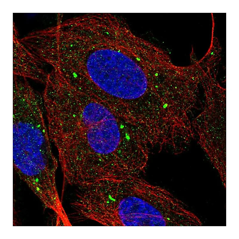 Atlas Antibodies Anti-SCARB1 Antibody