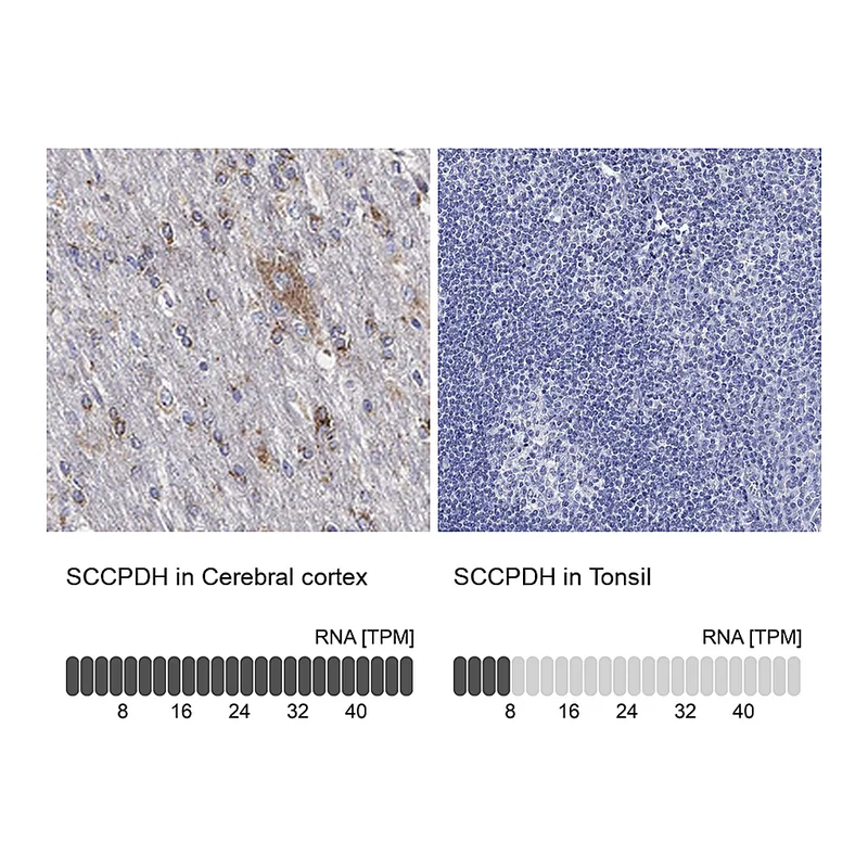 Atlas Antibodies Anti-SCCPDH Antibody