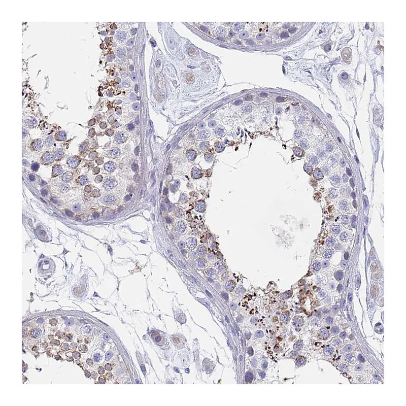 Atlas Antibodies Anti-SCCPDH Antibody