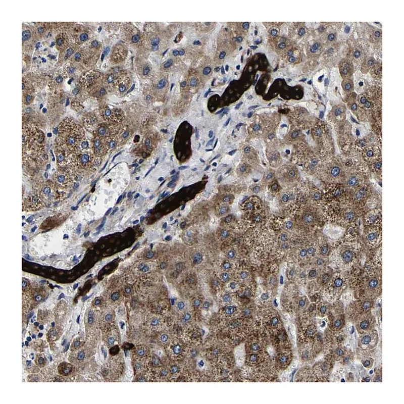 Atlas Antibodies Anti-SCD Antibody
