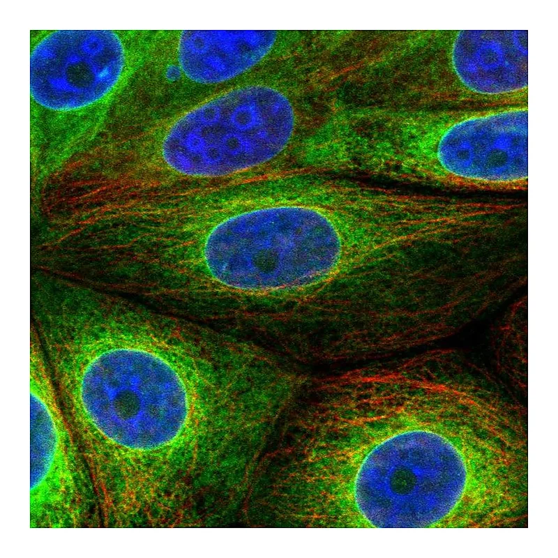 Atlas Antibodies Anti-SCD Antibody