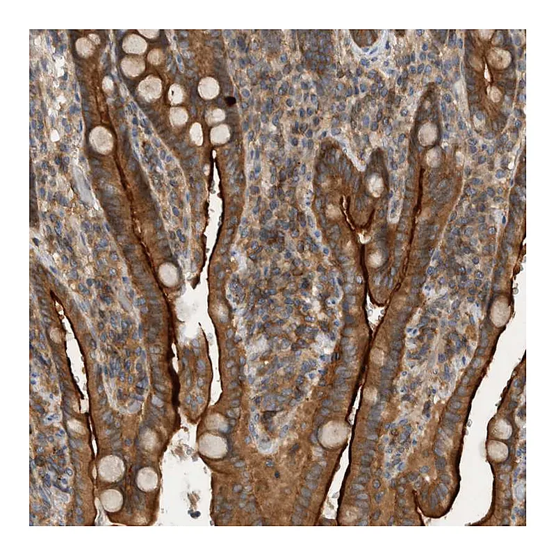 Atlas Antibodies Anti-SCARA5 Antibody