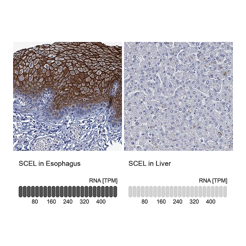 Atlas Antibodies Anti-SCEL Antibody