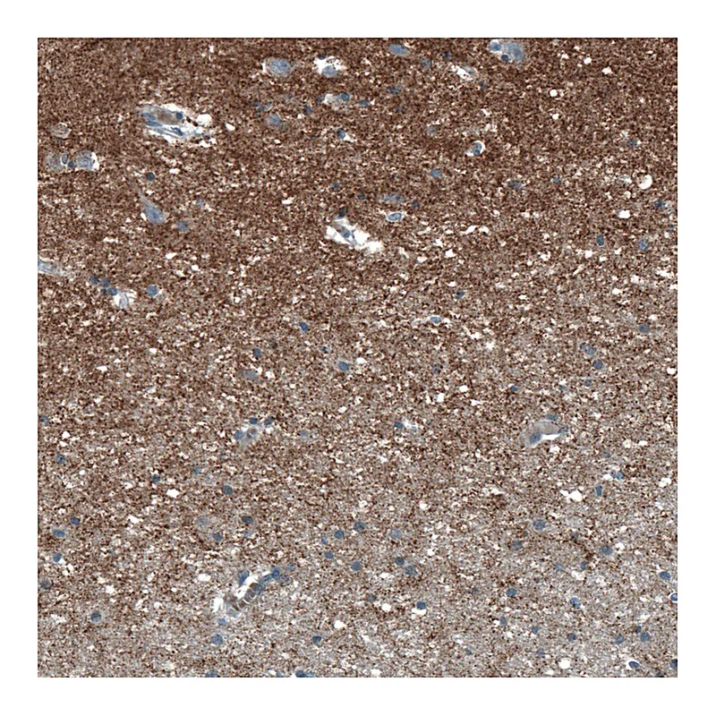 Atlas Antibodies Anti-SCD5 Antibody