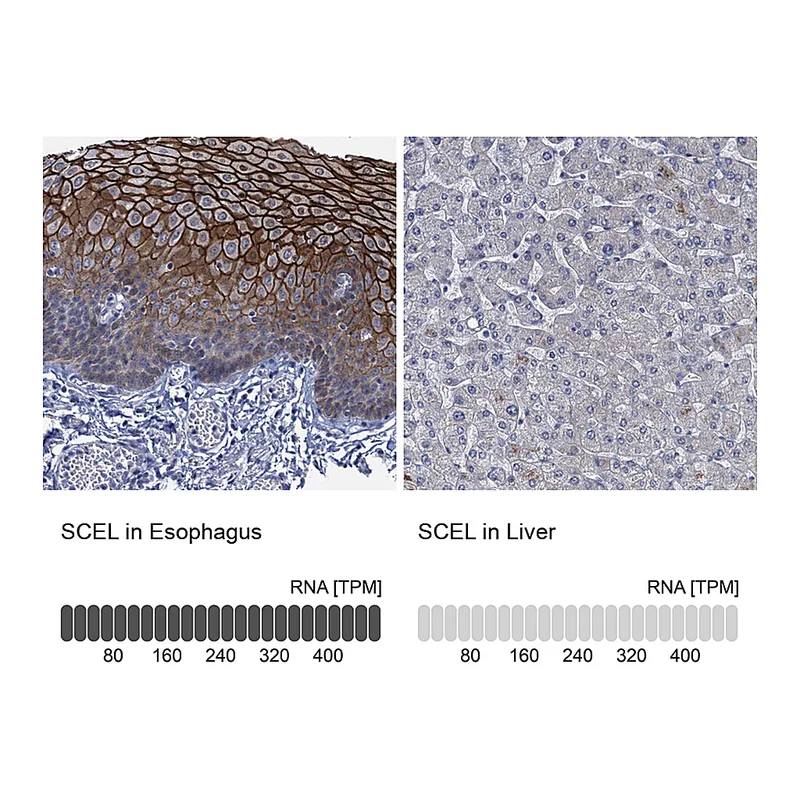Atlas Antibodies Anti-SCEL Antibody