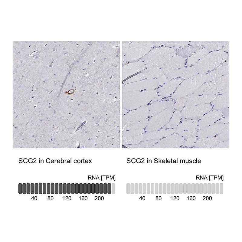 Atlas Antibodies Anti-SCG2 Antibody