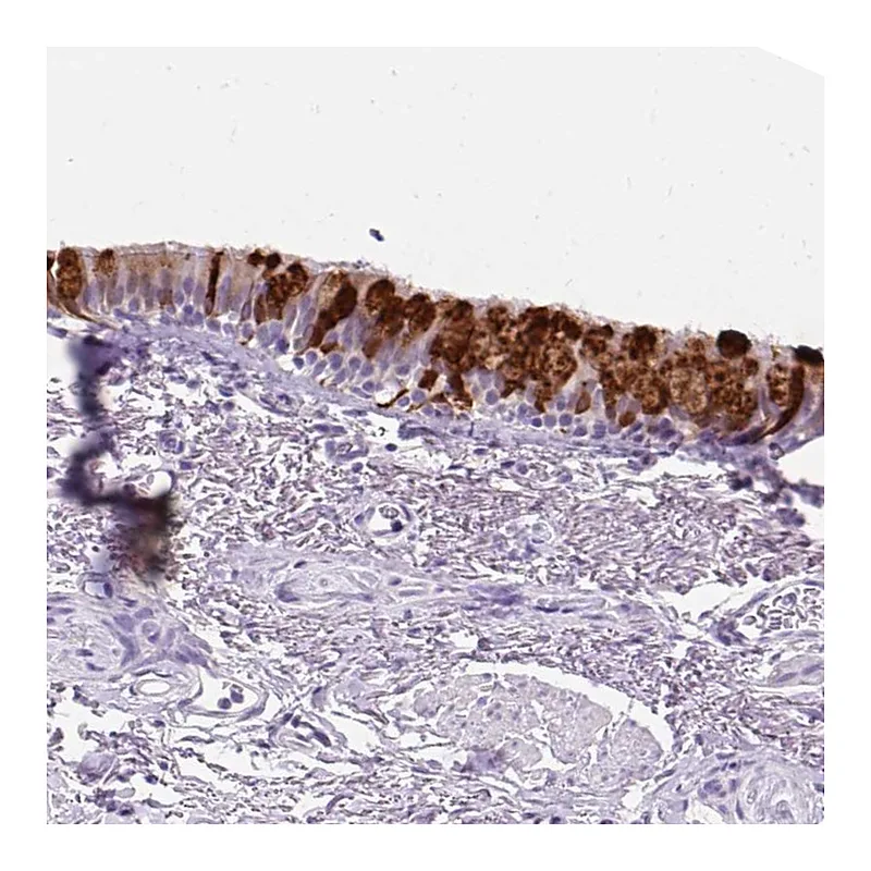 Atlas Antibodies Anti-SCGB1A1 Antibody