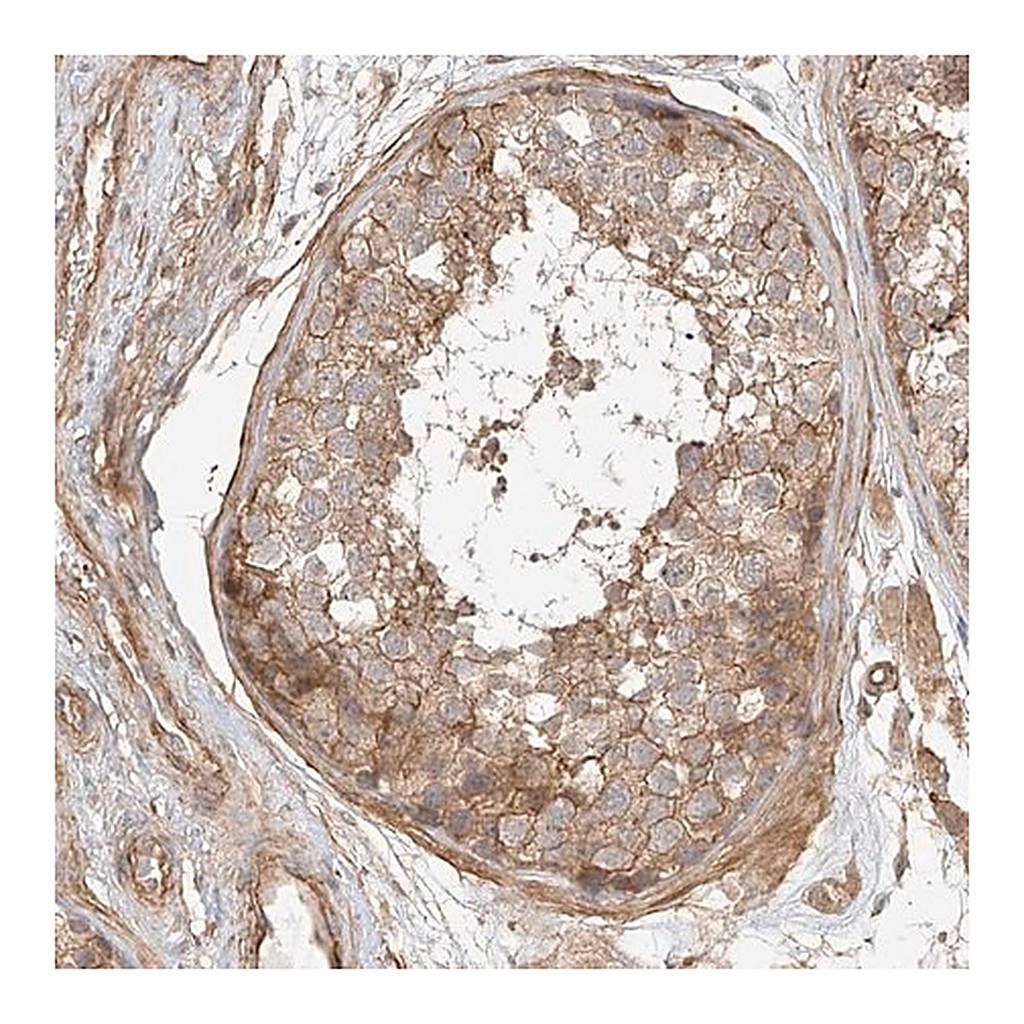 Merck Anti-CSMD3 antibody produced in rabbit